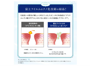 Lunamea AC (Fujifilm) Skin Conditioner, Lotion Acne Prevention - YOYO JAPAN