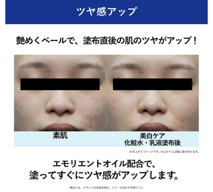 AQUALABEL Treatment Milk Brightening Moisturizing (130ml) - YOYO JAPAN