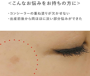 Ampoule Luxury White Concentrate HQ110 Spot Intensive Serum - YOYO JAPAN