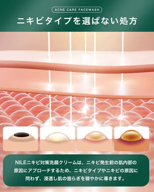 Nile Acne Cleansing Care Glycyrrhizic Acid Quasi - Drug 150G