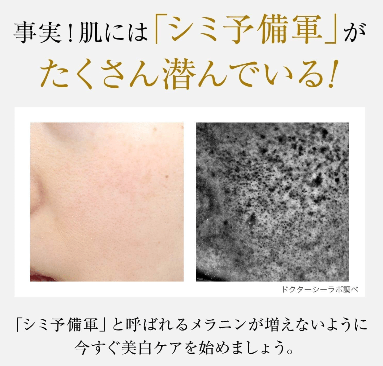 (Old Model) Medicinal Aqua Collagen Gel Whitening EX (120 g)