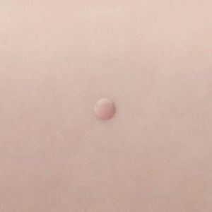 Potunt Spot Powder Essence Ac Care Serum - Japanese Beauty Must Try Skincare