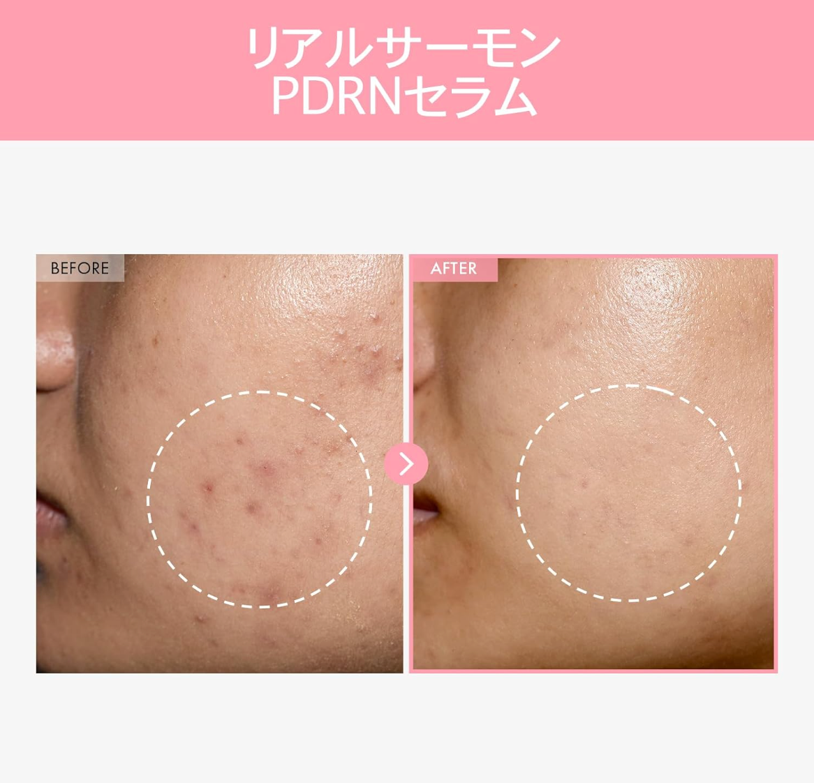 TOSOWOONG Pink Peptide 12 PDRN Serum